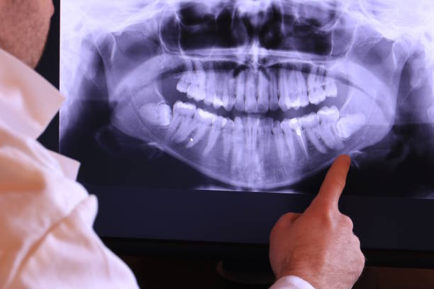Best Holiday Emergency Dentist in Portland, TX