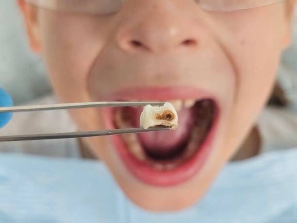 Best Mobile Emergency Dentist in Portland, TX