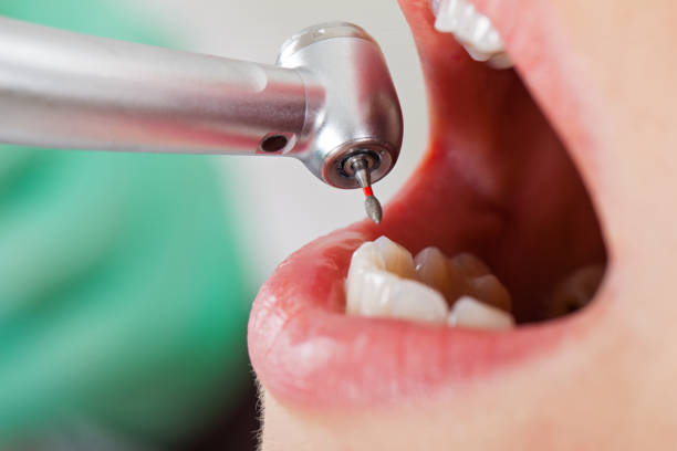 Best Mobile Emergency Dentist in Portland, TX